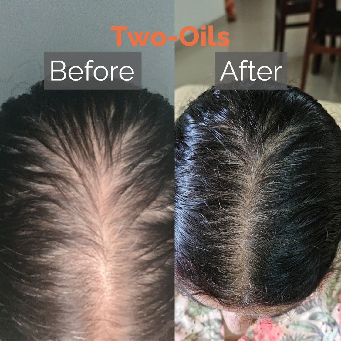 Essential Hair Care Kit (for Normal/Oily Scalp) | Two-Oils + Shampoo